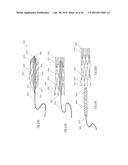 CLOT RETRIEVAL DEVICE FOR REMOVING CLOT FROM A BLOOD VESSEL diagram and image