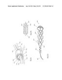 CLOT RETRIEVAL DEVICE FOR REMOVING CLOT FROM A BLOOD VESSEL diagram and image