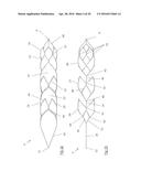 CLOT RETRIEVAL DEVICE FOR REMOVING CLOT FROM A BLOOD VESSEL diagram and image