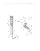 CLOT RETRIEVAL DEVICE FOR REMOVING CLOT FROM A BLOOD VESSEL diagram and image