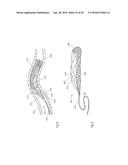 CLOT RETRIEVAL DEVICE FOR REMOVING CLOT FROM A BLOOD VESSEL diagram and image