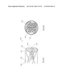 CLOT RETRIEVAL DEVICE FOR REMOVING CLOT FROM A BLOOD VESSEL diagram and image