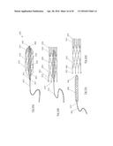 CLOT RETRIEVAL DEVICE FOR REMOVING CLOT FROM A BLOOD VESSEL diagram and image