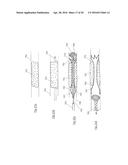 CLOT RETRIEVAL DEVICE FOR REMOVING CLOT FROM A BLOOD VESSEL diagram and image