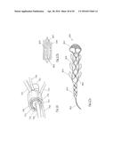 CLOT RETRIEVAL DEVICE FOR REMOVING CLOT FROM A BLOOD VESSEL diagram and image