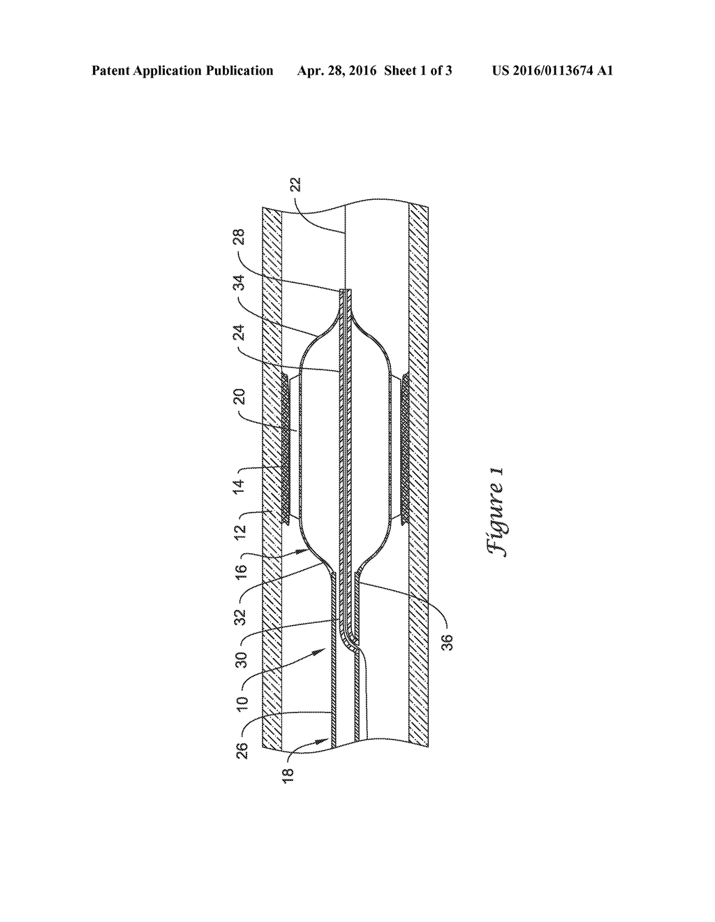 CUTTING BALLOON CATHETER AND METHOD FOR BLADE MOUNTING - diagram, schematic, and image 02