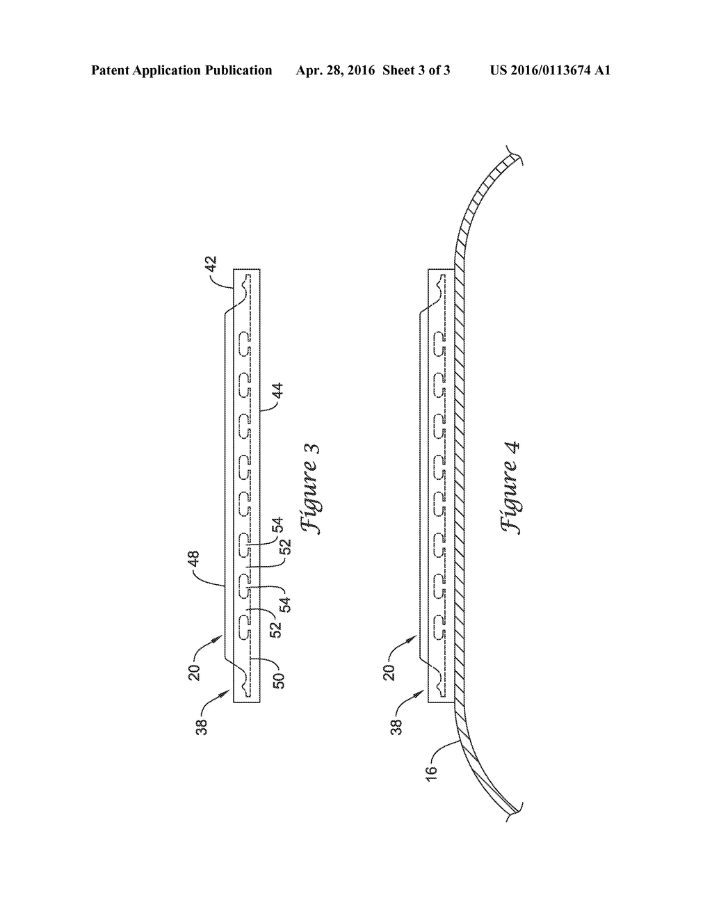 CUTTING BALLOON CATHETER AND METHOD FOR BLADE MOUNTING - diagram, schematic, and image 04