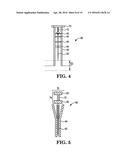 METHOD AND DEVICE FOR CONTROLLED DELIVERY OF MEDICAL DEVICES diagram and image