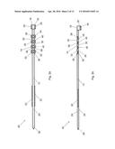 FIXATION ASSEMBLY WITH A FLEXIBLE ELONGATED MEMBER FOR SECURING PARTS OF A     STERNUM diagram and image