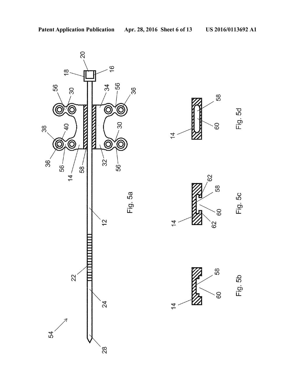 FIXATION ASSEMBLY WITH A FLEXIBLE ELONGATED MEMBER FOR SECURING PARTS OF A     STERNUM - diagram, schematic, and image 07