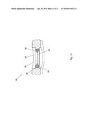 FIXATION ASSEMBLY WITH A FLEXIBLE ELONGATED MEMBER FOR SECURING PARTS OF A     STERNUM diagram and image