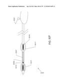 DEVICES AND METHODS FOR RENAL DENERVATION AND ASSESSMENT THEREOF diagram and image