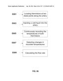 DEVICES AND METHODS FOR RENAL DENERVATION AND ASSESSMENT THEREOF diagram and image