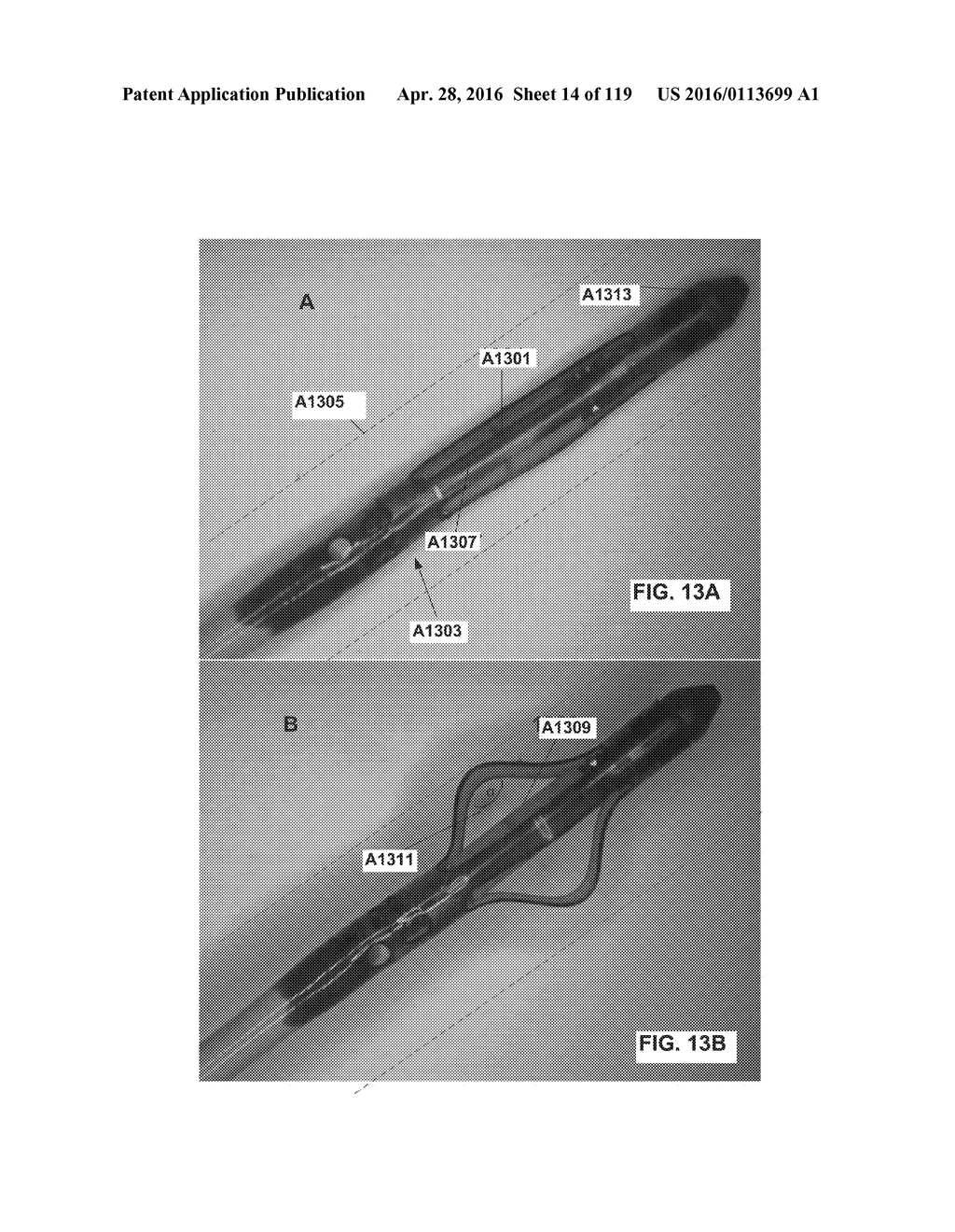 DEVICES AND METHODS FOR RENAL DENERVATION AND ASSESSMENT THEREOF - diagram, schematic, and image 15