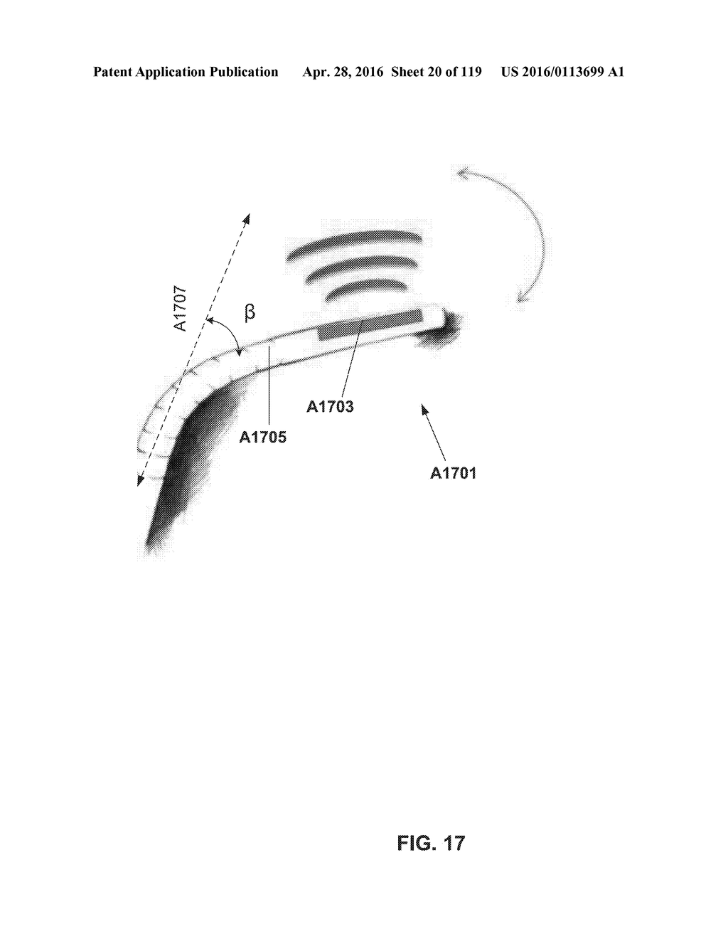 DEVICES AND METHODS FOR RENAL DENERVATION AND ASSESSMENT THEREOF - diagram, schematic, and image 21