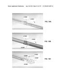 DEVICES AND METHODS FOR RENAL DENERVATION AND ASSESSMENT THEREOF diagram and image