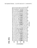 DEVICES AND METHODS FOR RENAL DENERVATION AND ASSESSMENT THEREOF diagram and image