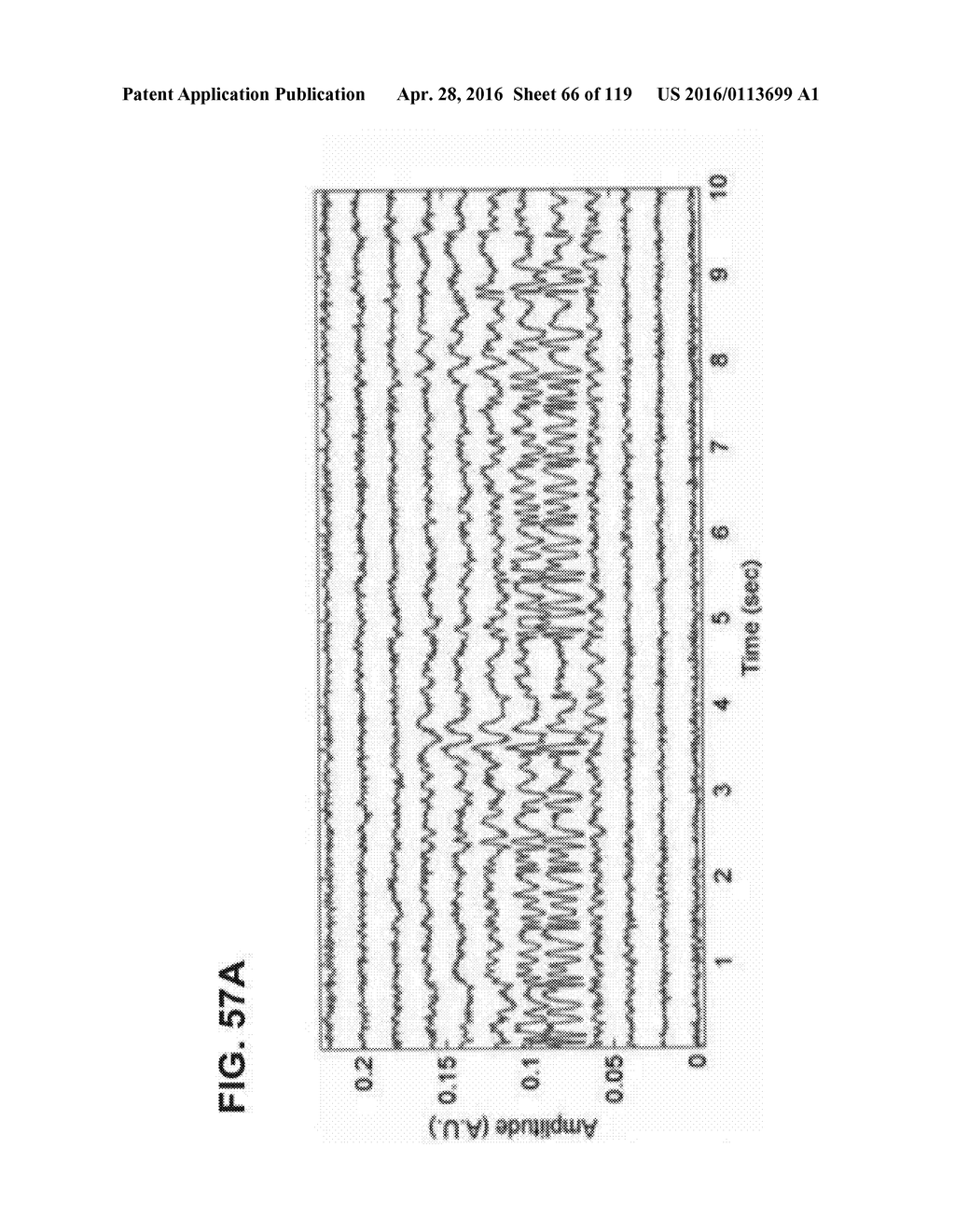 DEVICES AND METHODS FOR RENAL DENERVATION AND ASSESSMENT THEREOF - diagram, schematic, and image 67