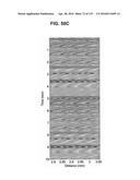 DEVICES AND METHODS FOR RENAL DENERVATION AND ASSESSMENT THEREOF diagram and image