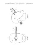 HEAD CLAMP FOR IMAGING AND NEUROSURGERY diagram and image