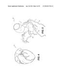 METHOD AND SYSTEM FOR IMAGE PROCESSING TO DETERMINE PATIENT-SPECIFIC BLOOD     FLOW CHARACTERISTICS diagram and image