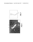 METHOD AND SYSTEM FOR IMAGE PROCESSING TO DETERMINE PATIENT-SPECIFIC BLOOD     FLOW CHARACTERISTICS diagram and image