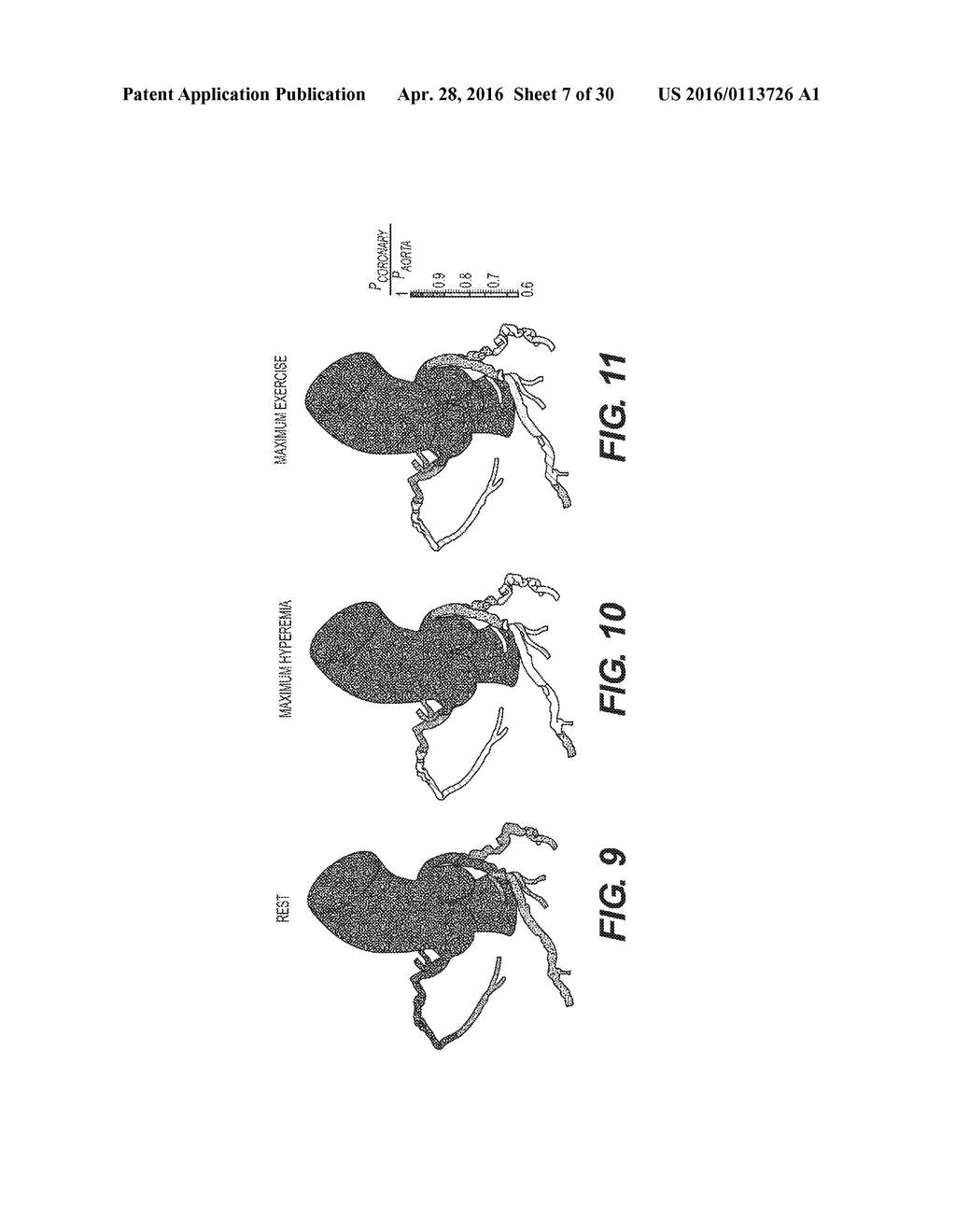 METHOD AND SYSTEM FOR IMAGE PROCESSING TO DETERMINE PATIENT-SPECIFIC BLOOD     FLOW CHARACTERISTICS - diagram, schematic, and image 08