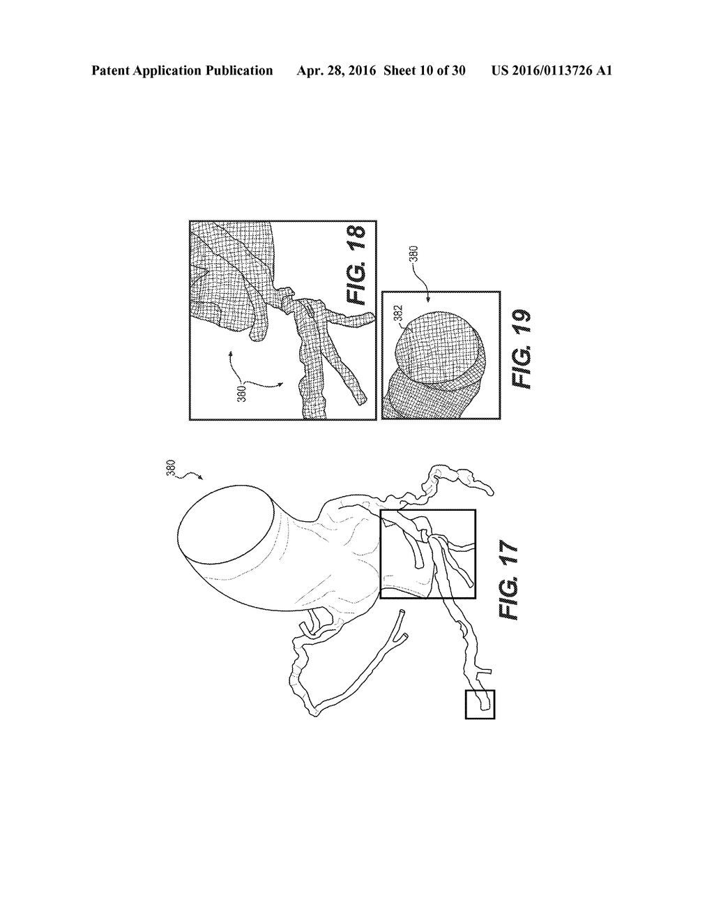 METHOD AND SYSTEM FOR IMAGE PROCESSING TO DETERMINE PATIENT-SPECIFIC BLOOD     FLOW CHARACTERISTICS - diagram, schematic, and image 11