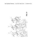 METHOD AND SYSTEM FOR IMAGE PROCESSING TO DETERMINE PATIENT-SPECIFIC BLOOD     FLOW CHARACTERISTICS diagram and image