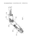 SURGICAL TOOL diagram and image