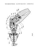 SURGICAL TOOL diagram and image