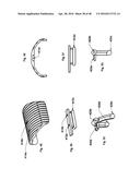 SURGICAL TOOL diagram and image