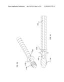 DENTAL IMPLANT DEVICE, SYSTEM AND METHOD OF USE diagram and image