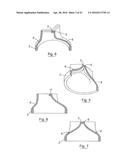 UROLOGICAL DEVICE diagram and image