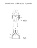 UROLOGICAL DEVICE diagram and image