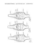 UROLOGICAL DEVICE diagram and image