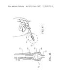 UROLOGICAL DEVICE diagram and image