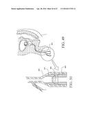 UROLOGICAL DEVICE diagram and image