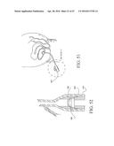 UROLOGICAL DEVICE diagram and image