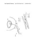 UROLOGICAL DEVICE diagram and image