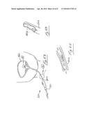 UROLOGICAL DEVICE diagram and image