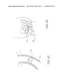 UROLOGICAL DEVICE diagram and image