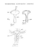 UROLOGICAL DEVICE diagram and image