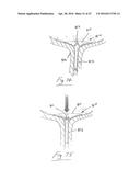 UROLOGICAL DEVICE diagram and image