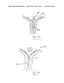 UROLOGICAL DEVICE diagram and image