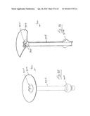 UROLOGICAL DEVICE diagram and image