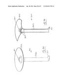 UROLOGICAL DEVICE diagram and image