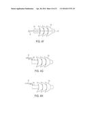 ATRAUMATIC MEDICAL DEVICE ANCHORING AND DELIVERY SYSTEM WITH ENHANCED     ANCHORING diagram and image