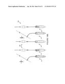 ATRAUMATIC MEDICAL DEVICE ANCHORING AND DELIVERY SYSTEM WITH ENHANCED     ANCHORING diagram and image