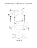 ATRAUMATIC MEDICAL DEVICE ANCHORING AND DELIVERY SYSTEM WITH ENHANCED     ANCHORING diagram and image